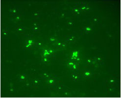 LED荧光显微镜在生殖道疾病检测中的应用