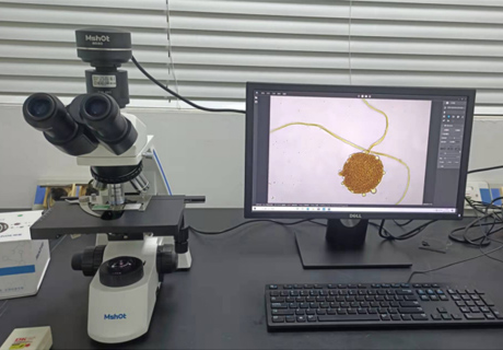生物显微镜ML31搭配显微镜相机MS60观察到毛霉