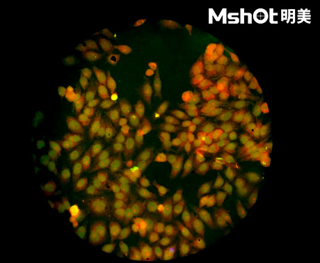 荧光生物显微镜应用于ANA-HEp2免疫荧光诊断