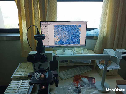 明美显微镜相机应用于教学案例爬片观察
