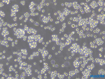倒置荧光显微镜应用于活细胞生长状况以及蛋白质荧光转染效率观察