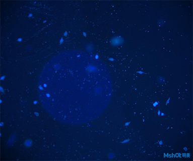 明美荧光显微镜应用于深圳市龙华中心医院中心实验室免疫细胞筛查
