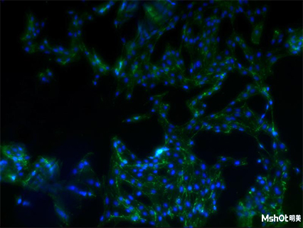 明美荧光显微镜应用于细胞爬片观察
