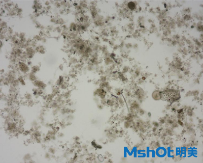 微拟球藻采用什么显微镜观察？