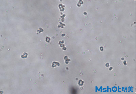 生物显微镜下的乳酸菌