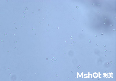 国产生物显微镜搭配显微镜相机观察到乳酸菌
