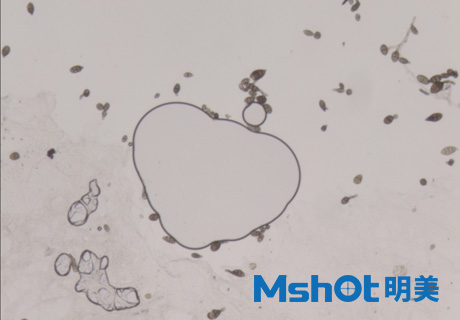 真菌检测一般配备什么显微镜？