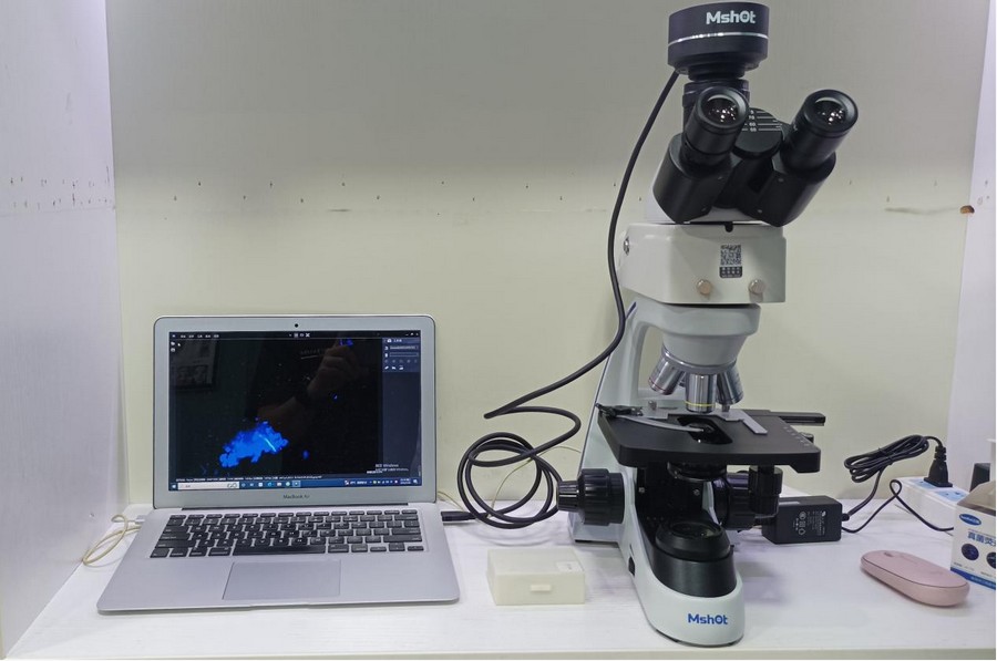 荧光显微镜下的真菌性皮肤病|应用百科