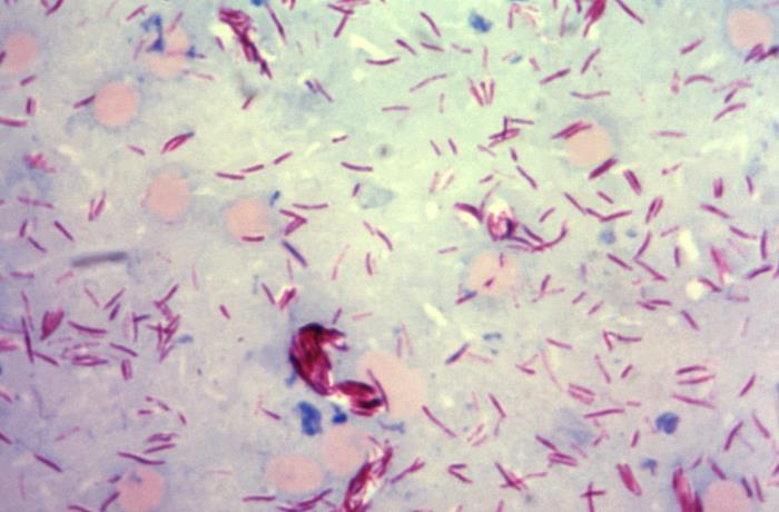 生物显微镜下的麻风分枝杆菌|应用百科